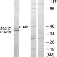 Western blot analysis of extracts from COS7 cells, untreated or treated with serum (10%, 30mins), using SOX8/9/17/18 antibody.