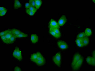 Immunofluorescence staining of HepG2 cells with CSB-PA725885LA01HU at 1:33, counter-stained with DAPI. The cells were fixed in 4% formaldehyde, permeabilized using 0.2% Triton X-100 and blocked in 10% normal Goat Serum. The cells were then incubat...