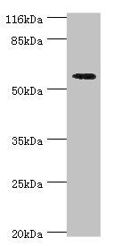 Western blot All lanes: ACBD5 antibody at 2µg/ml + Hela whole cell lysate Secondary Goat polyclonal to rabbit IgG at 1/10000 dilution Predicted band size: 61, 55, 59, 47 kDa Observed band size: 61 kDa