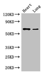 Western Blot Positive WB detected in: Mouse heart tissue, Mouse lung tissue All lanes: DCAF8 antibody at 3.5ug/ml Secondary Goat polyclonal to rabbit IgG at 1/50000 dilution Predicted band size: 67, 31 kDa Observed band size: 67 kDa