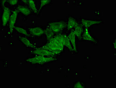 Immunofluorescent analysis of Hela cells using CSB-PA725899LA01HU at dilution of 1:100 and Alexa Fluor 488-congugated AffiniPure Goat Anti-Rabbit IgG(H+L)