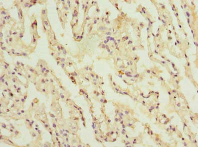 Immunohistochemistry of paraffin-embedded human lung tissue using CSB-PA725903LA01HU at dilution of 1:100