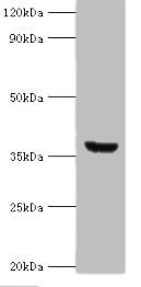 Western blot All lanes: ANXA8L2 antibody at 18ug/ml + HepG2 whole cell lysate Secondary Goat polyclonal to rabbit IgG at 1/10000 dilution Predicted band size: 37, 31 kDa Observed band size: 37 kDa
