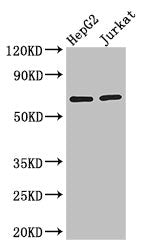 Western Blot Positive WB detected in: HepG2 whole cell lysate, Jurkat whole cell lysate All lanes: RUNX1T1 antibody at 2.8ug/ml Secondary Goat polyclonal to rabbit IgG at 1/50000 dilution Predicted band size: 68, 65, 69, 64, 49, 45 kDa Observed ba...