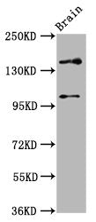 Western Blot Positive WB detected in: Rat brain tissue All lanes: SOS1 antibody at 4.6ug/ml Secondary Goat polyclonal to rabbit IgG at 1/50000 dilution Predicted band size: 153, 37 kDa Observed band size: 153 kDa