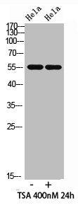 Western blot analysis of hela cells,hela cells, antibody was diluted at 500. Secondary antibody was diluted at 1:20000