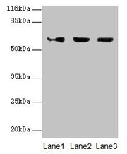 Western blot All lanes: ATL3 antibody at 2µg/ml Lane 1: Jurkat whole cell lysate Lane 2: Hela whole cell lysate Lane 3: HepG2 whole cell lysate Secondary Goat polyclonal to rabbit IgG at 1/10000 dilution Predicted band size: 61 kDa Observed band s...
