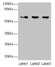 Western blot All lanes: ATL3 antibody at 2µg/ml Lane 1: Jurkat whole cell lysate Lane 2: Hela whole cell lysate Lane 3: HepG2 whole cell lysate Secondary Goat polyclonal to rabbit IgG at 1/10000 dilution Predicted band size: 61 kDa Observed band s...