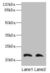 Western blot All lanes: LGALS9C antibody at 4µg/ml Lane 1: Mouse stomach tissue Lane 2: Mouse liver tissue Secondary Goat polyclonal to rabbit IgG at 1/10000 dilution Predicted band size: 40 kDa Observed band size: 22 kDa