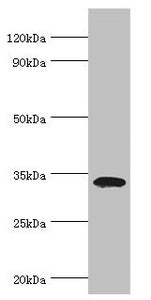 Western blot All lanes: Low density lipoprotein receptor adapter protein 1 antibody at 4ug/ml + Mouse liver tissue Secondary Goat polyclonal to rabbit IgG at 1/10000 dilution Predicted band size: 34 kDa Observed band size: 34 kDa