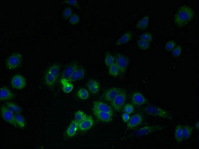 Immunofluorescent analysis of HepG2 cells using CSB-PA729206LA01HU at dilution of 1:100 and Alexa Fluor 488-congugated AffiniPure Goat Anti-Rabbit IgG(H+L)