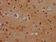 IHC image of CSB-PA729212LA01HU diluted at 1:400 and staining in paraffin-embedded human brain tissue performed on a Leica BondTM system. After dewaxing and hydration, antigen retrieval was mediated by high pressure in a citrate buffer (pH 6.0). S...