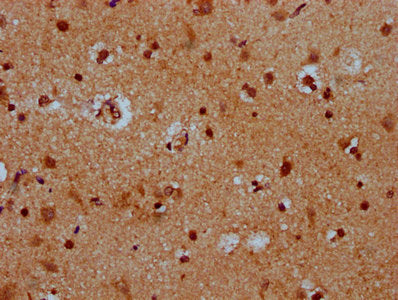 IHC image of CSB-PA729212LA01HU diluted at 1:400 and staining in paraffin-embedded human brain tissue performed on a Leica BondTM system. After dewaxing and hydration, antigen retrieval was mediated by high pressure in a citrate buffer (pH 6.0). S...