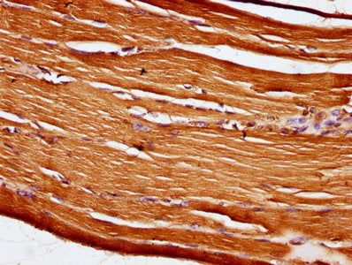 IHC image of CSB-PA729422LA01HU diluted at 1:100 and staining in paraffin-embedded human skeletal muscle tissue performed on a Leica BondTM system. After dewaxing and hydration, antigen retrieval was mediated by high pressure in a citrate buffer (...