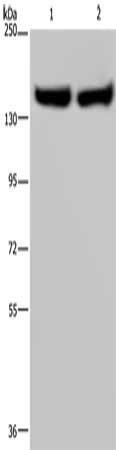 Gel: 6%SDS-PAGE, Lysate: 40 ug, Lane 1-2: Human placenta tissue, Human fetal liver tissue, Primary antibody: CSB-PA729448(ITGA2B Antibody) at dilution 1/650, Secondary antibody: Goat anti rabbit IgG at 1/8000 dilution, Exposure time: 5 minutes