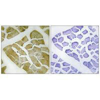 Immunohistochemistry analysis of paraffin-embedded human skeletal muscle tissue using MYH4 antibody.