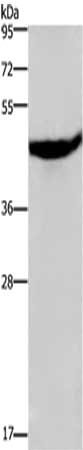 Gel: 8%SDS-PAGE,Lysate: 40 ug,,Primary antibody: CSB-PA730026(CXCR2 Antibody) at dilution 1/500 dilution,Secondary antibody: Goat anti rabbit IgG at 1/8000 dilution,Exposure time: 2 minutes