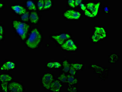Immunofluorescence staining of Hela cells with CSB-PA730138OA01HU at 1:50, counter-stained with DAPI. The cells were fixed in 4% formaldehyde, permeabilized using 0.2% Triton X-100 and blocked in 10% normal Goat Serum. The cells were then incubate...
