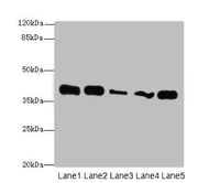Western blot All lanes: KHDRBS2 antibody at 7µg/ml Lane 1: K562 whole cell lysate Lane 2: Hela whole cell lysate Lane 3: A431 whole cell lysate Lane 4: Jurkat whole cell lysate Lane 5: NIH/3T3 whole cell lysate Secondary Goat polyclonal to rabbit...