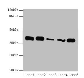 Western blot All lanes: KHDRBS2 antibody at 7µg/ml Lane 1: K562 whole cell lysate Lane 2: Hela whole cell lysate Lane 3: A431 whole cell lysate Lane 4: Jurkat whole cell lysate Lane 5: NIH/3T3 whole cell lysate Secondary Goat polyclonal to rabbit...