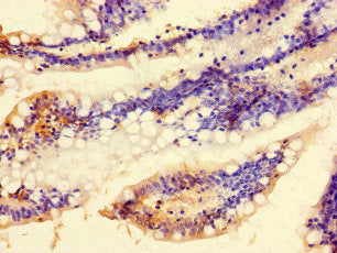 Immunohistochemistry of paraffin-embedded human small intestine tissue using CSB-PA730146LA01HU at dilution of 1:100