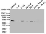 Western Blot Positive WB detected in: 293T whole cell lysate (20µg), U87 whole cell lysate (20µg), U251 whole cell lysate (20µg), SY5Y whole cell lysate (20µg), PC-3 whole cell lysate (20µg), Mouse brain tissue lysate (20µg), Rat brain tissue lysa...