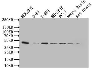 Western Blot Positive WB detected in: 293T whole cell lysate (20µg), U87 whole cell lysate (20µg), U251 whole cell lysate (20µg), SY5Y whole cell lysate (20µg), PC-3 whole cell lysate (20µg), Mouse brain tissue lysate (20µg), Rat brain tissue lysa...
