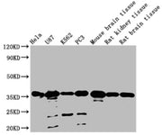 Western Blot Positive WB detected in: Hela whole cell lysate, U87 whole cell lysate, K562 whole cell lysate, PC3 whole cell lysate, Mouse brain tissue, Rat kidney tissue, Rat brain tissue All lanes: METRNL antibody at 1:2000 Secondary Goat polyclo...