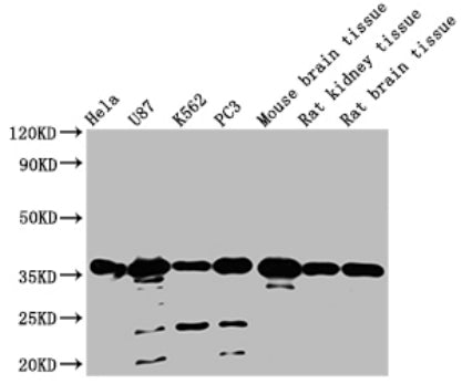Western Blot Positive WB detected in: Hela whole cell lysate, U87 whole cell lysate, K562 whole cell lysate, PC3 whole cell lysate, Mouse brain tissue, Rat kidney tissue, Rat brain tissue All lanes: METRNL antibody at 1:2000 Secondary Goat polyclo...