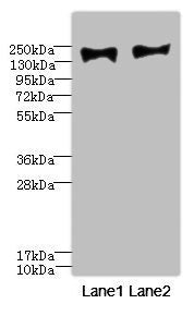 Western blot All lanes: MRC2 antibody at 3.84ug/ml Lane 1: HepG2 whole cell lysate Lane 2: A549 whole cell lysate Secondary Goat polyclonal to rabbit IgG at 1/10000 dilution Predicted band size: 167 kDa Observed band size: 167 kDa