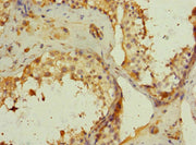 Immunohistochemistry of paraffin-embedded human testis tissue using CSB-PA731055ESR2HU at dilution of 1:100