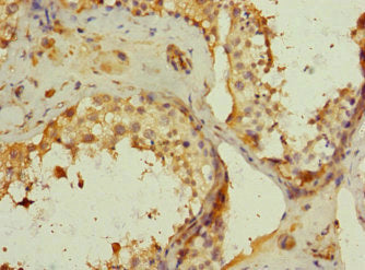 Immunohistochemistry of paraffin-embedded human testis tissue using CSB-PA731055ESR2HU at dilution of 1:100