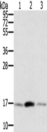 Gel: 12%SDS-PAGE, Lysate: 40 ug, Lane 1-3: Hela cells, hepg2 cells, PC3 cells, Primary antibody: CSB-PA731155(PPIA Antibody) at dilution 1/300, Secondary antibody: Goat anti rabbit IgG at 1/8000 dilution, Exposure time: 5 seconds