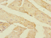 Immunohistochemistry of paraffin-embedded human skeletal muscle tissue using CSB-PA731560LA01HU at dilution of 1:100
