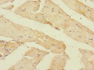 Immunohistochemistry of paraffin-embedded human skeletal muscle tissue using CSB-PA731560LA01HU at dilution of 1:100