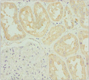 Immunohistochemistry of paraffin-embedded human kidney tissue using CSB-PA731561ESR1HU at dilution of 1:100