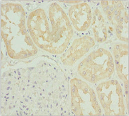 Immunohistochemistry of paraffin-embedded human kidney tissue using CSB-PA731561ESR1HU at dilution of 1:100