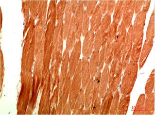 Immunohistochemical analysis of paraffin-embedded Human Skeletal Muscle Tissue using ATG4c Rabbit pAb diluted at 1:200