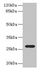 Western blot All lanes: TEX35 antibody at 4µg/ml + U251 whole cell lysate Secondary Goat polyclonal to rabbit IgG at 1/10000 dilution Predicted band size: 27, 26, 24, 21, 25 kDa Observed band size: 27 kDa