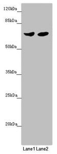 Western blot All lanes: RARS2 antibody at 2.68 ug/ml Lane 1: Mouse kidney tissue Lane 2: HL60 whole cell lysate Secondary Goat polyclonal to rabbit IgG at 1/10000 dilution Predicted band size: 66 kDa Observed band size: 66 kDa