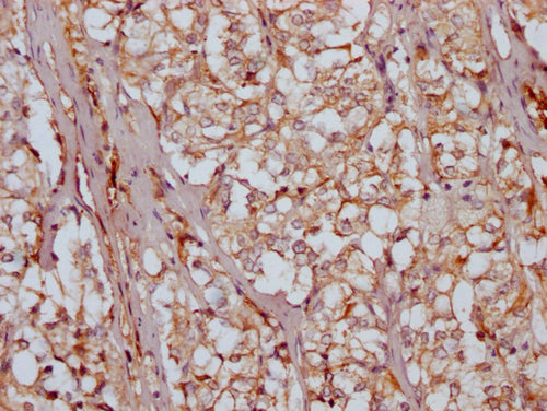 IHC image of CSB-PA732918LA01HU diluted at 1:200 and staining in paraffin-embedded human adrenal gland tissue performed on a Leica BondTM system. After dewaxing and hydration, antigen retrieval was mediated by high pressure in a citrate buffer (pH...