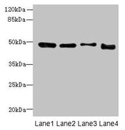 Western blot All lanes: DDI2 antibody at 4µg/ml Lane 1: A431 whole cell lysate Lane 2: HL60 whole cell lysate Lane 3: K562 whole cell lysate Lane 4: Caco-2 whole cell lysate Secondary Goat polyclonal to rabbit IgG at 1/10000 dilution Predicted ban...