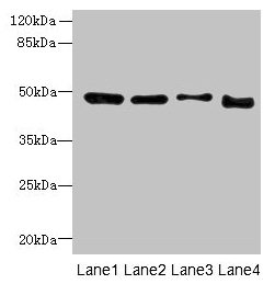 Western blot All lanes: DDI2 antibody at 4µg/ml Lane 1: A431 whole cell lysate Lane 2: HL60 whole cell lysate Lane 3: K562 whole cell lysate Lane 4: Caco-2 whole cell lysate Secondary Goat polyclonal to rabbit IgG at 1/10000 dilution Predicted ban...