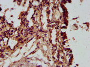 IHC image of CSB-PA732977LA01HU diluted at 1:300 and staining in paraffin-embedded human lung tissue performed on a Leica BondTM system. After dewaxing and hydration, antigen retrieval was mediated by high pressure in a citrate buffer (pH 6.0). Se...