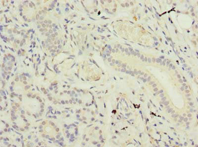 Immunohistochemistry of paraffin-embedded human pancreatic tissue using CSB-PA733164LA01HU at dilution of 1:100