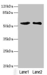 Western blot All lanes: SLC30A1 antibody at 3.75ug/ml Lane 1: A549 whole cell lysate Lane 2: HepG2 whole cell lysate Secondary Goat polyclonal to rabbit IgG at 1/10000 dilution Predicted band size: 55 kDa Observed band size: 55 kDa