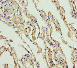 Immunohistochemistry of paraffin-embedded human lung tissue using CSB-PA733714DSR1HU at dilution of 1:100