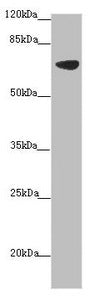 Western blot All lanes: SLC34A1 antibody at 2.34 ug/ml + Mouse brain tissue Secondary Goat polyclonal to rabbit IgG at 1/10000 dilution Predicted band size: 69, 37 kDa Observed band size: 69 kDa