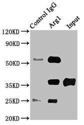 Immunoprecipitating Arg1 in Rat liver tissue Lane 1: Rabbit control IgG instead of CSB-PA733775HA01MO in Rat liver tissue. For western blotting, a HRP-conjugated Protein G antibody was used as the secondary antibody (1/2000) Lane 2: CSB-PA733775HA...