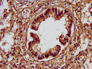 IHC image of CSB-PA733819LA01HU diluted at 1:200 and staining in paraffin-embedded human lung tissue performed on a Leica BondTM system. After dewaxing and hydration, antigen retrieval was mediated by high pressure in a citrate buffer (pH 6.0). Se...